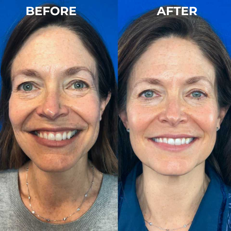 <p><strong>Why Women Are Obsessed</strong></p>